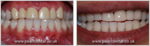 smile-gallery6